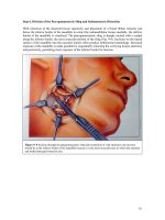 General Principles for Approaches to the Facial Skeleton - part 8 ppsx