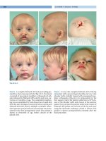 Cleft Lip and Palate - part 7 docx