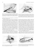 Craniomaxillofacial Reconstructive and Corrective Bone Surgery - part 5 pot