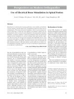 Sử dụng điện Kích thích xương cột sống pot