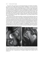 Treatment of Osteoarthritic Change in the Hip - part 7 ppsx