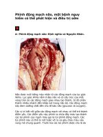 phình động mạch não