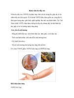 Bệnh viêm da tiếp xúc pptx