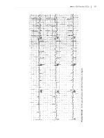 150 Practice ECGs: Interpretation and Review - Part 6 doc