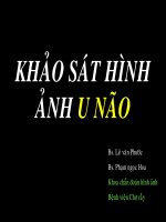 khảo sát hình ảnh u não