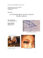 Vắc xin phòng bệnh than do vi khuẩn bacillus anthracis