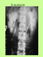 Hình ảnh về các bệnh về tiết niệu