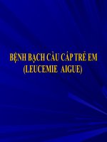 Bệnh cạch cầu ở trẻ em