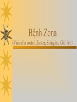 Bài giảng về bệnh zona