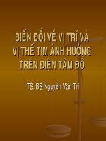 Biến đổi vị trí tim ảnh hưởng trên điện tâm đồ