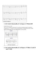 Tổng quan về điện tâm đồ