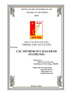 Các mô hình suy hao kênh PATHLOSS  Thông tin vô tuyến