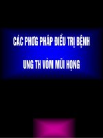 Phương pháp điều trị ung thư vòm mũi họng