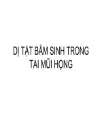 Dị tật bẩm sinh do tai mũi họng