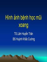 Hình ảnh bệnh học mũi xoang