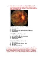 Thăm khám và chẩn đoán về mắt