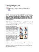 so cuu nguoi ngung tim