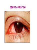 tuyen truyen benh dau mat do