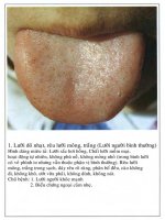 Thiet chan tứ chẩn y học cổ truyền