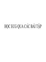 Học ECG qua các bài tập