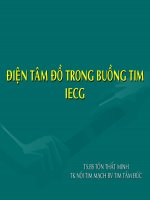 Slide điện tâm đồ trong buồng tim IECG