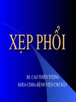 slide xẹp phổi, BS.Cao Thiên Tượng