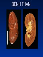 Tài liệu bài giảng bệnh thận