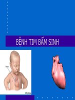 Bệnh tim bẩm sinh