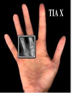 Bài giảng Vật Lý  12. Bài 28 Tia Ronhgen