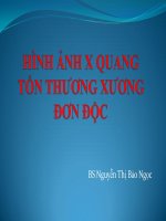 Hình ảnh X-Quang tổn thương xương đòn dọc