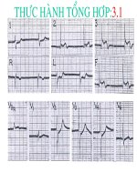 thực hành tổng hợp điện tâm đồ nhĩ thất