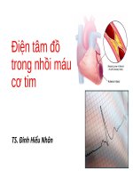 Điện tâm đồ trong nhồi máu cơ tim.PPT