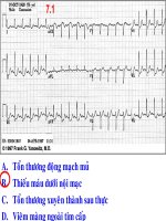 thực hành điện tâm đồ tim