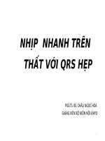 nhịp nhanh trên thất với QRS hẹp