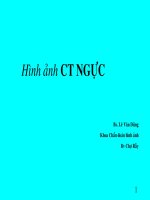 bài giảng giải phẫu ngực.PPT