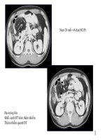 hình ảnh chấn thương ổ bụng