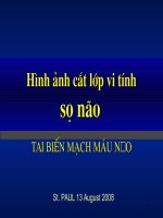Hình ảnh cắt lớp vi tính sọ não.PPT