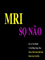 MRI Cộng hưởng từ sọ não