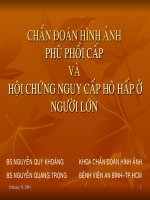 XQ chẩn đoán hình ảnh phù phổi cấp ADRS
