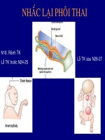 Siêu âm nhắc lại phôi thai