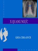 bài giảng xquang ngực