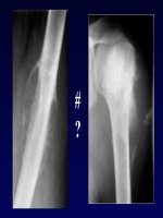 Ôn tập đọc phim x quang