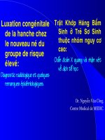 X quang trật khớp háng bẩm sinh