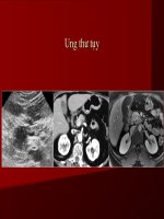 Siêu âm ung thư tụy