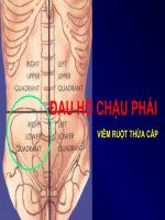 Siêu âm đau hố chậu phải viêm ruột thừa cấp