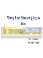 Những hình ảnh siêu âm sỏi thận