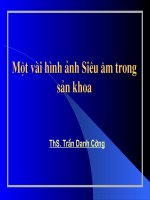 Một vài hình ảnh siêu âm trong sản khoa