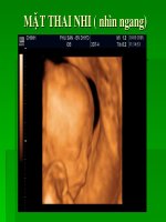 Siêu âm sản ba tháng cuối