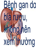 BI GAN DO UONG IT BIA RUOU