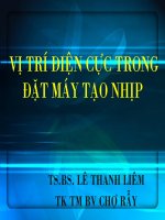 Vị trí điện cực trong đặt máy tạo nhịp